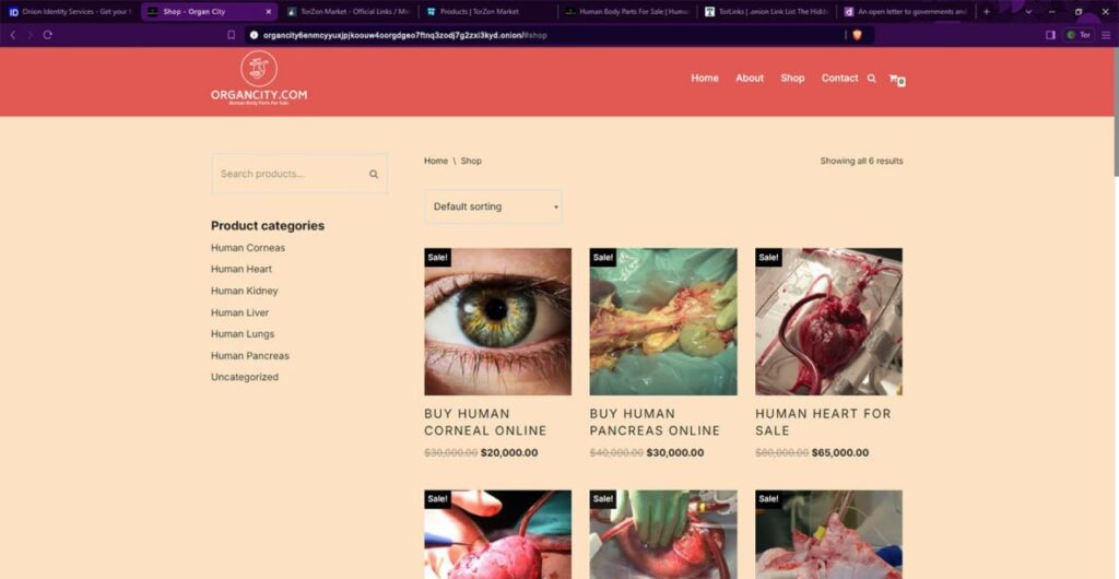 Der illegale Organhandel über Organcity.com - Eine Mistsplitter-Team Recherche